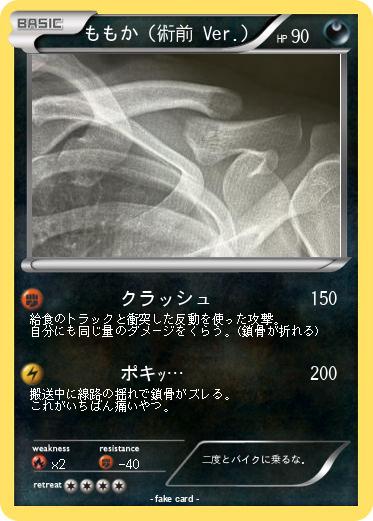 Pokemon ももか（術前 Ver.）