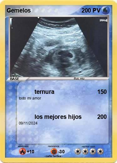 Pokemon Gemelos