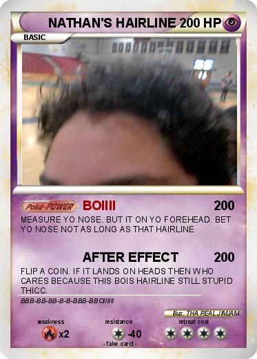 Pokemon NATHAN'S HAIRLINE
