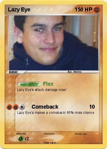 Pokemon Lazy Eye