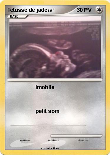 Pokemon fetusse de jade