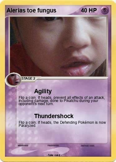 Pokemon Alerias toe fungus