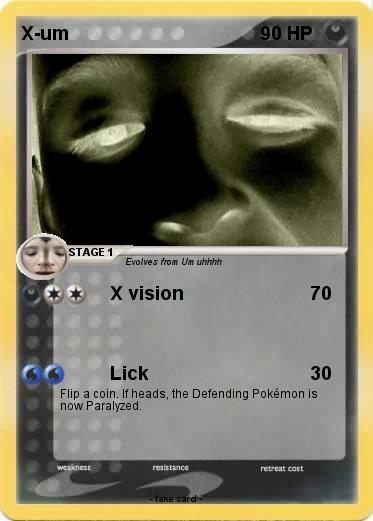 Pokemon X-um