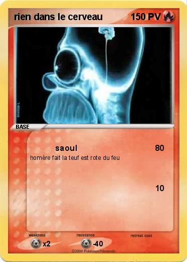 Pokemon rien dans le cerveau 