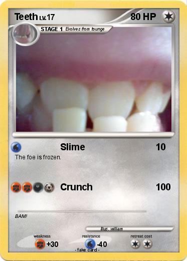 Pokemon Teeth