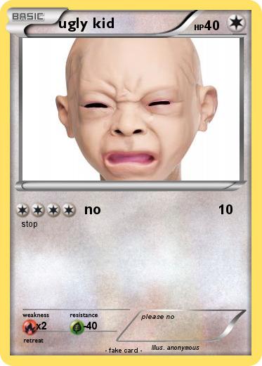 Pokemon ugly kid