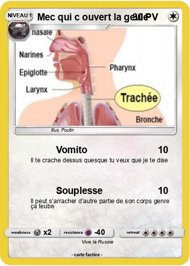 Pokemon Mec qui c ouvert la geule