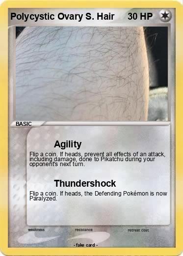 Pokemon Polycystic Ovary S. Hair