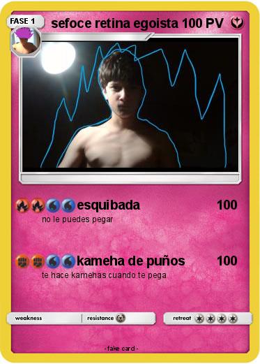 Pokemon sefoce retina egoista