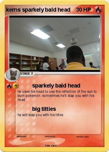 Pokemon kerns sparkely bald head