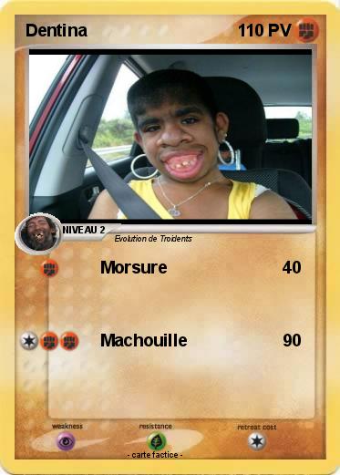 Pokemon Dentina