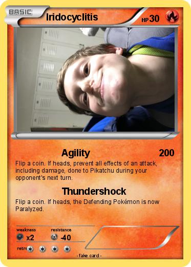 Pokemon Iridocyclitis