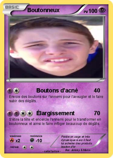 Pokemon Boutonneux