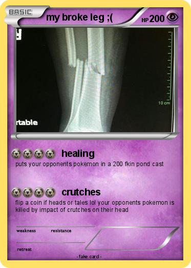 Pokemon my broke leg ;(