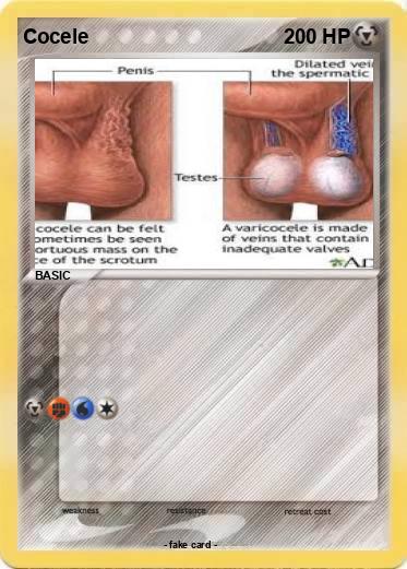 Pokemon Cocele
