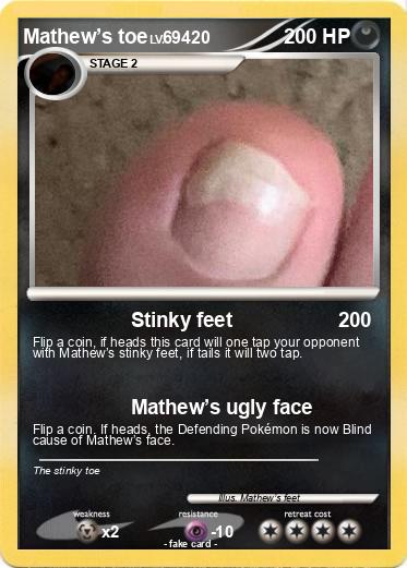 Pokemon Mathew’s toe