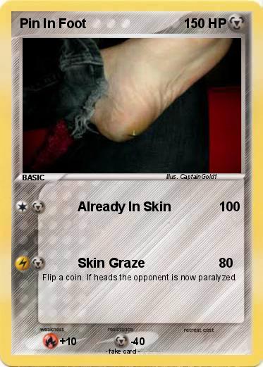 Pokemon Pin In Foot