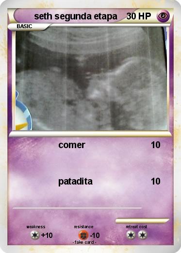 Pokemon seth segunda etapa