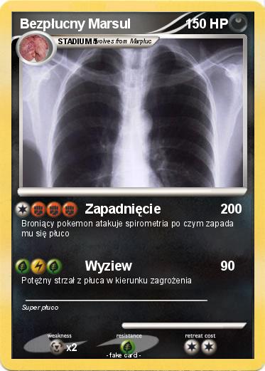 Pokemon Bezpłucny Marsul