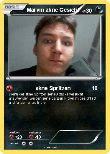 Pokemon Marvin akne Gesicht