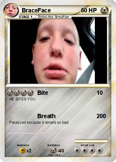 Pokemon BraceFace