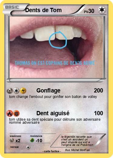 Pokemon Dents de Tom