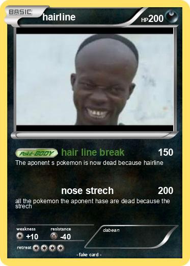 Pokemon hairline