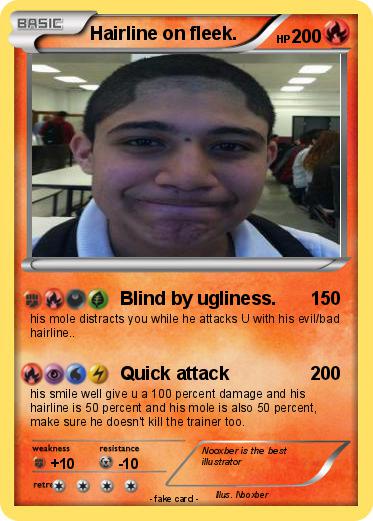Pokemon Hairline on fleek.