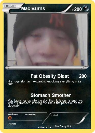Pokemon Mac Burns