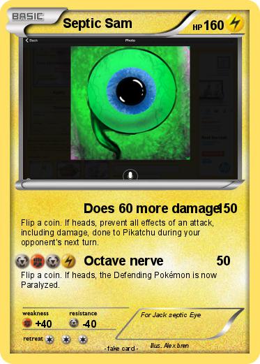 Pokemon Septic Sam