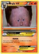 ugly kid