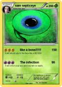 sam septiceye