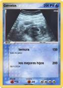 Gemelos