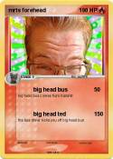 mrts forehead