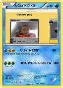 UGLY KID XD