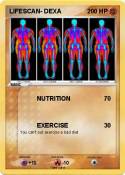 LIFESCAN- DEXA