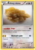 Kidney stone