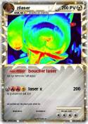 zilaser