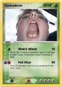 Kennedmon