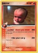 bald kid