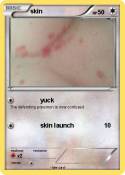 skin