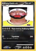 Anthony Davis