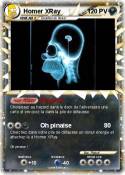 Homer XRay
