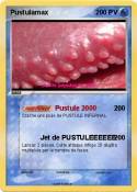 Pustulamax