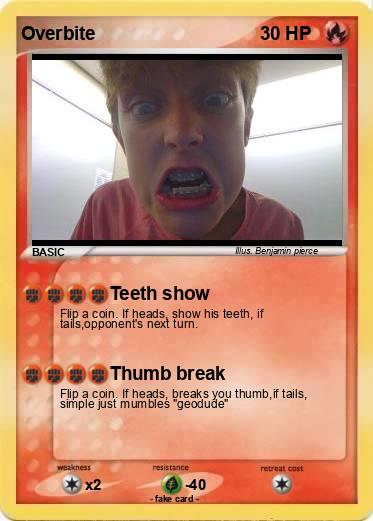 Pokemon Overbite