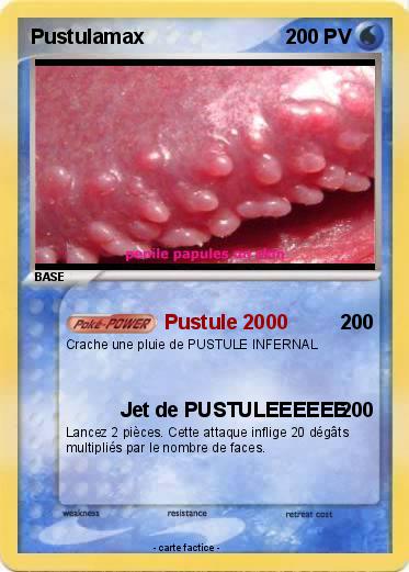 Pokemon Pustulamax